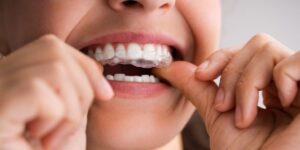 dentist in Manassas, VA