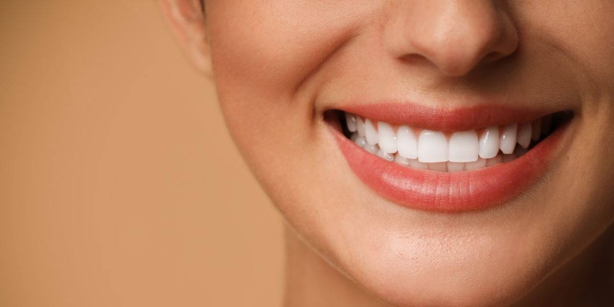 veneers in Manassas, VA