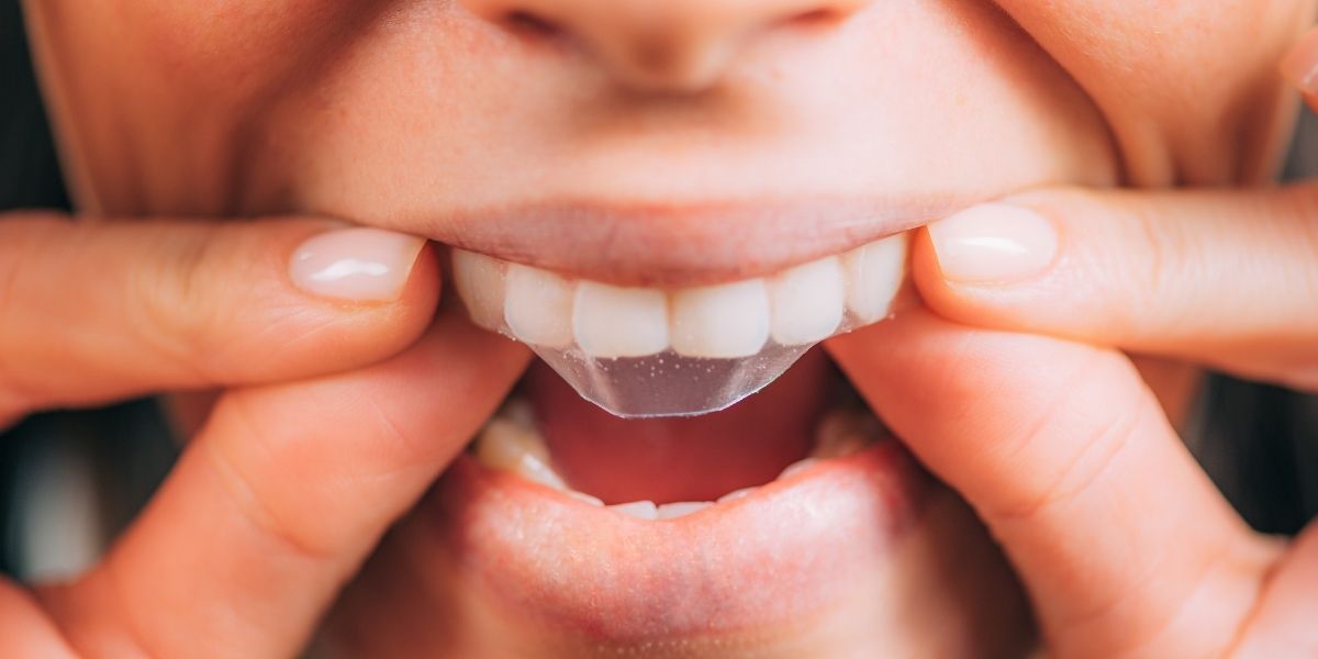dental clinic in Manassas, VA