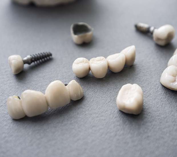 Manassas The Difference Between Dental Implants and Mini Dental Implants