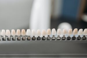 choosing dental veneers